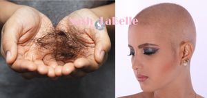 hair_thinning_cancer_hair_problems_alopecia_sashlabelle_hair_canada