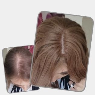 100% Remy Real Human Hair - Invisible U-CLIP Hair Extensions - Dark Brown