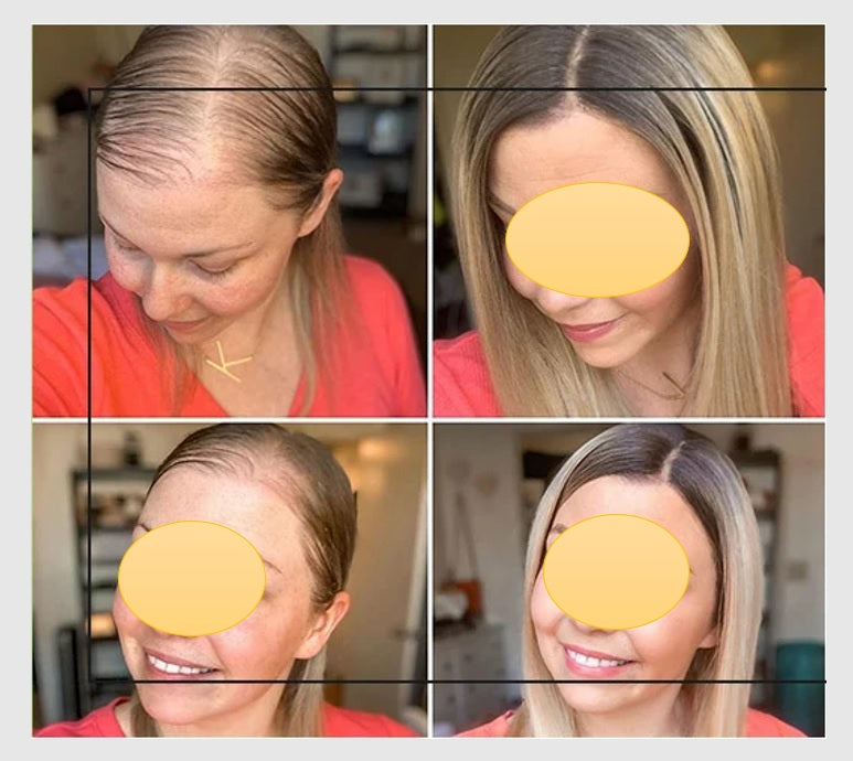 100% Remy Real Human Hair - Invisible U-CLIP Hair Extensions - Rooted Ash Blonde
